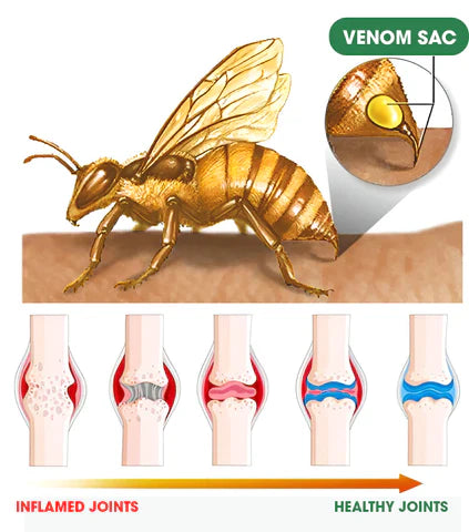 Image of BEE VENOM - Alivio en las articulaciones